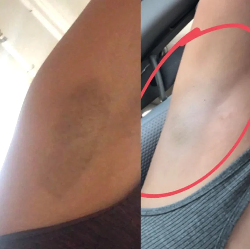 Crema Aclarante Aichun Beauty